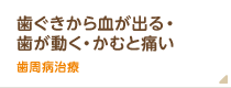 歯茎から血がでる、歯が動く、かむと痛いなら歯周病治療