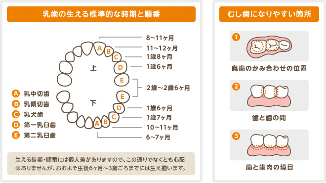 乳歯の生える時期と順番・虫歯になりやすい箇所の参考