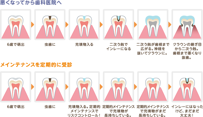 悪くなってから歯科医院へ行くスタイルでは、リスクが増大します