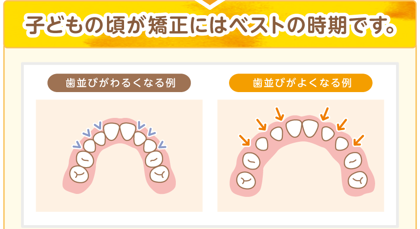 子どもの頃が矯正にはベストの時期です。