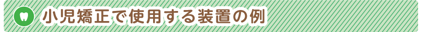 小児矯正で使用する装置の例